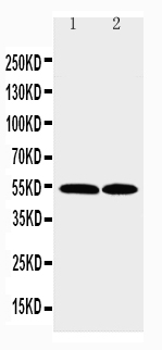 WB - Anti-CCR3 Antibody ABO11486